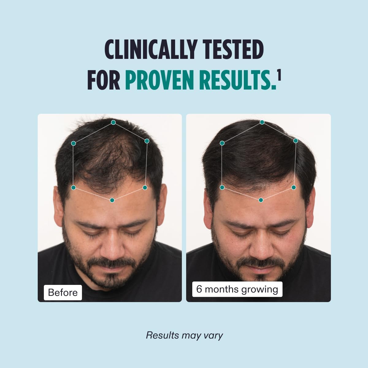Nutrafol Men's Hair